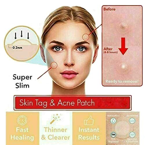 Ovanpa THE MAGIC SKIN PATCH - 24Pcs Skin Tag Removal Patch Blackhead Blemish Removers