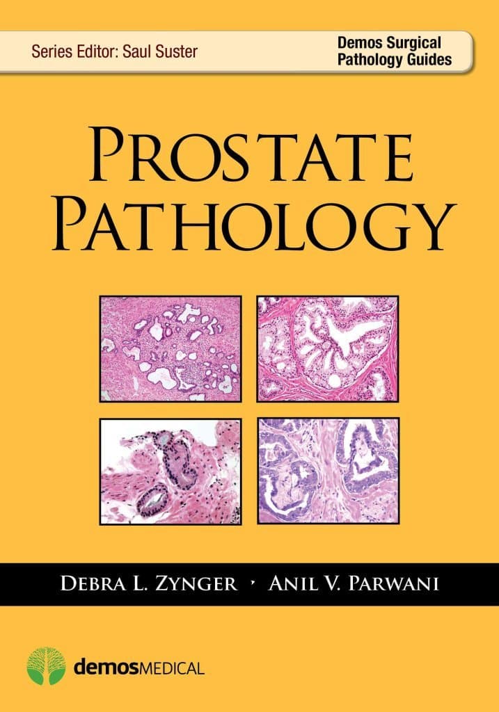 [(Prostate Pathology)] [Edited by Debra L. Zynger ] published on (August, 2014)