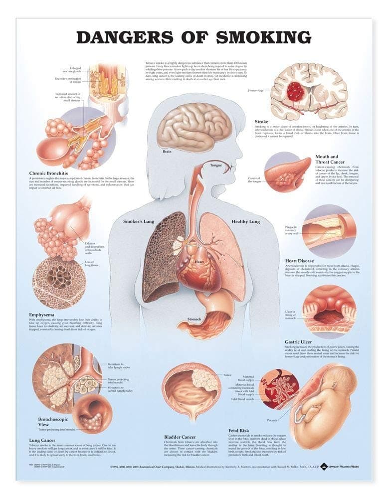 Dangers of Smoking Anatomical Chart