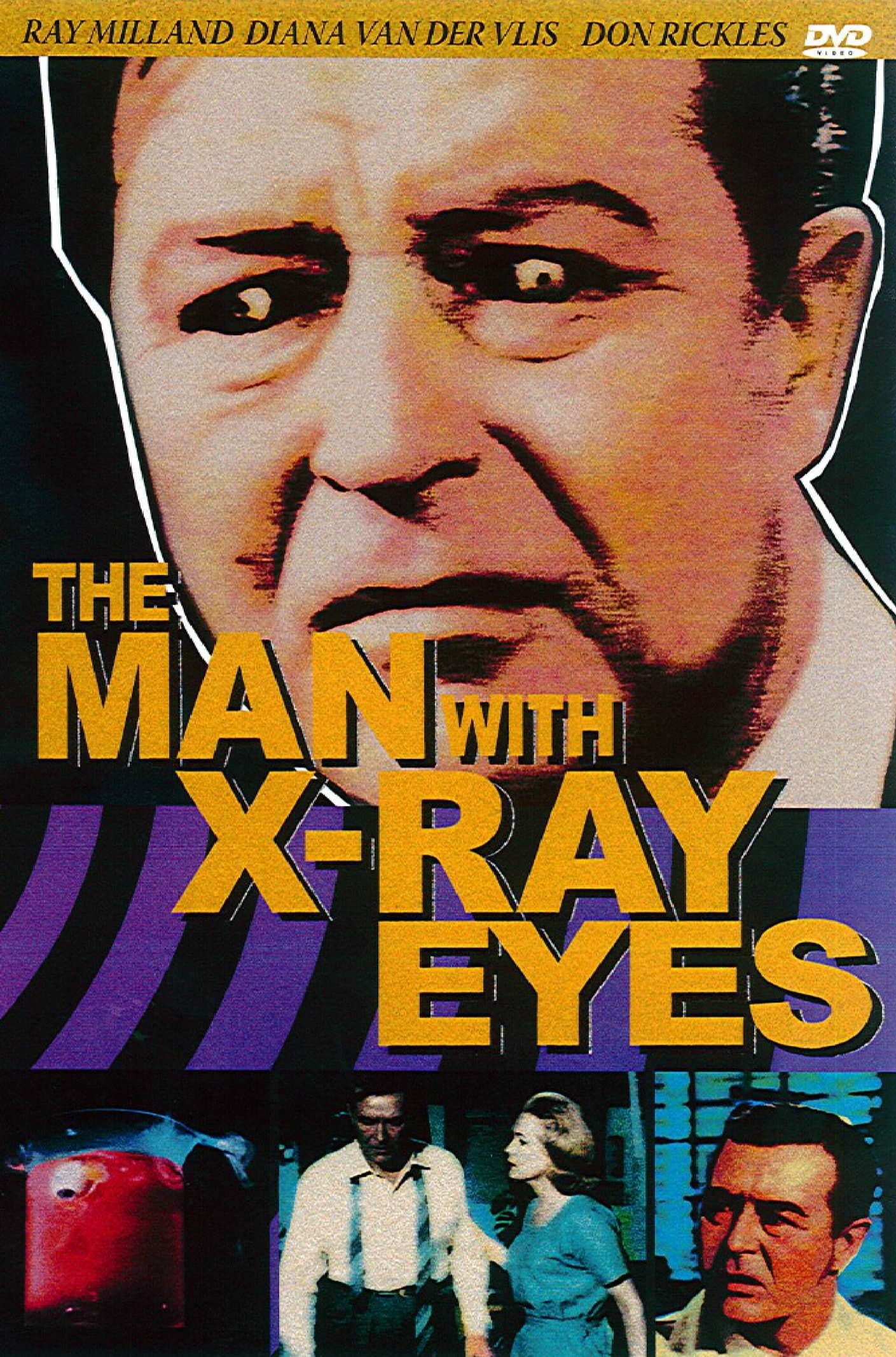 The Man with the X-Ray Eyes