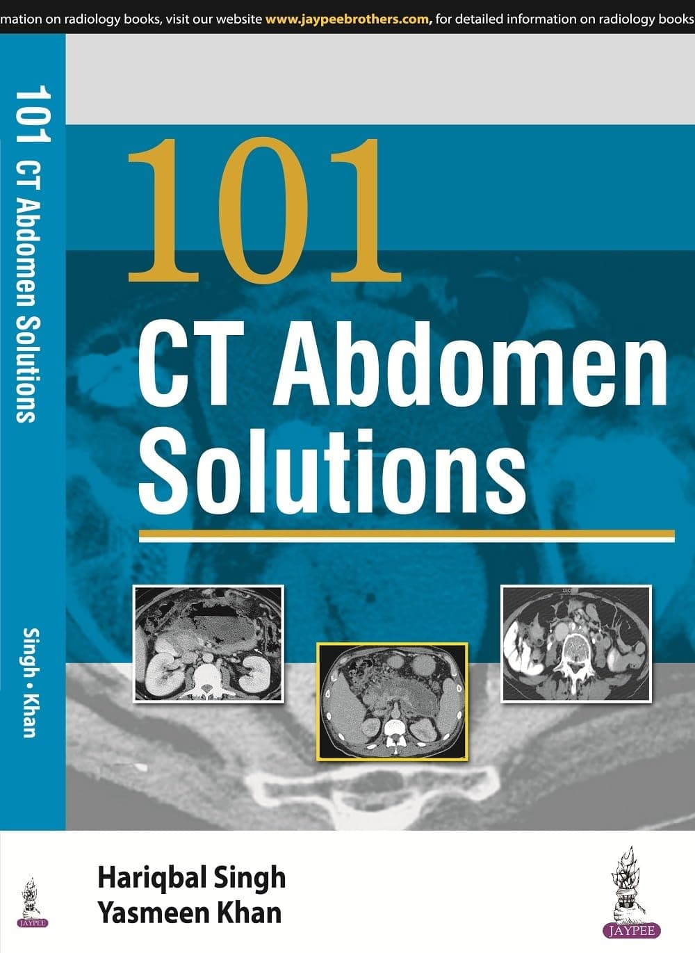 101 CT ABDOMEN SOLUTIONS Paperback – 1 January 2016